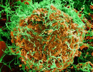 colorized scanning electron micrograph of Ebola virus particles (green) on the surface of infected cells (orange).