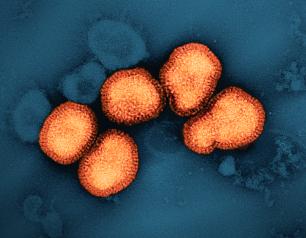 A colorized transmission electron micrograph of circular influenza A virus particles, colorized orange in this image, on a dark blue background.