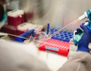 Researcher measures volume of cell cultures for an experiment.