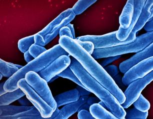 Scanning electron micrograph of Mycobacterium tuberculosis particles, the bacterium which causes TB