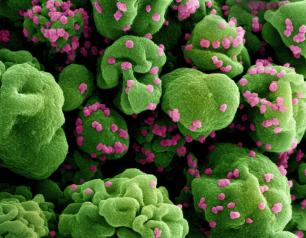 Colorized scanning electron micrograph of a cell (green) infected with SARS-CoV-2 virus particles, isolated from a patient sample.