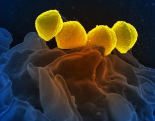 NeutrophilScanning electron micrograph of Group A Streptococcus