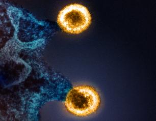 Black and dark blue granulated wavy matter with two light yellow spheres budding off to the right.