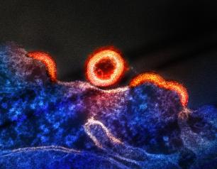 One orange, spherical immature virus particle is shown at the center of the image near the blue and purple H9 T-cell.