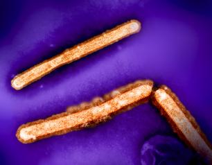 This image shows three influenza A (H5N1/bird flu) virus particles (rod-shaped; orange).