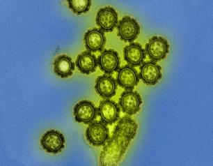 H1N1 Influenza Virus Particles