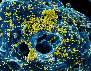 MERS virus cells