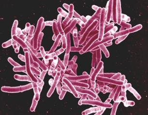 Scanning electron micrograph of Mycobacterium tuberculosis bacteria, which cause TB.