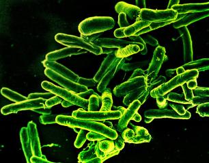 Scanning electron micrograph showing Mycobacterium tuberculosis bacteria (green), which cause TB.