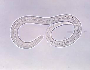 two loops show micrograph of parasitic worm larva