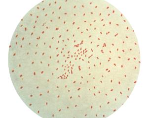 Pertussis (bordetella pertussis) bacteria