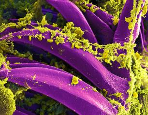 Scanning electron micrograph showing Yersinia pestis, which causes bubonic plague