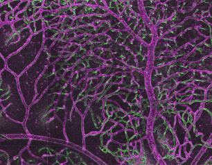 Image of vascular branches in the retina