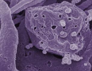 purple background of cells with yellow round balls virus