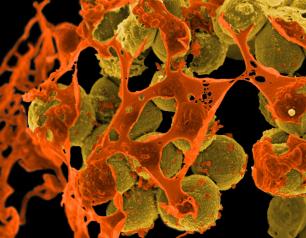 Image of Staphylococcus aureus a bacterium that causes frequent infections in people with STAT3 dominant-negative disease