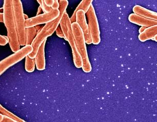 Scanning electron micrograph of Mycobacterium tuberculosis bacteria