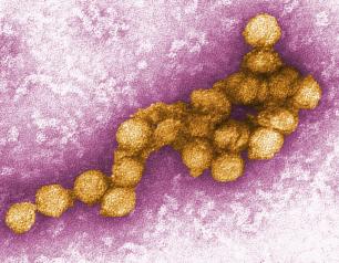 Image of West Nile Virus 