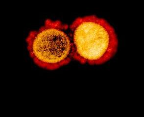 A red and yellow image of the novel coronavirus on a black background.