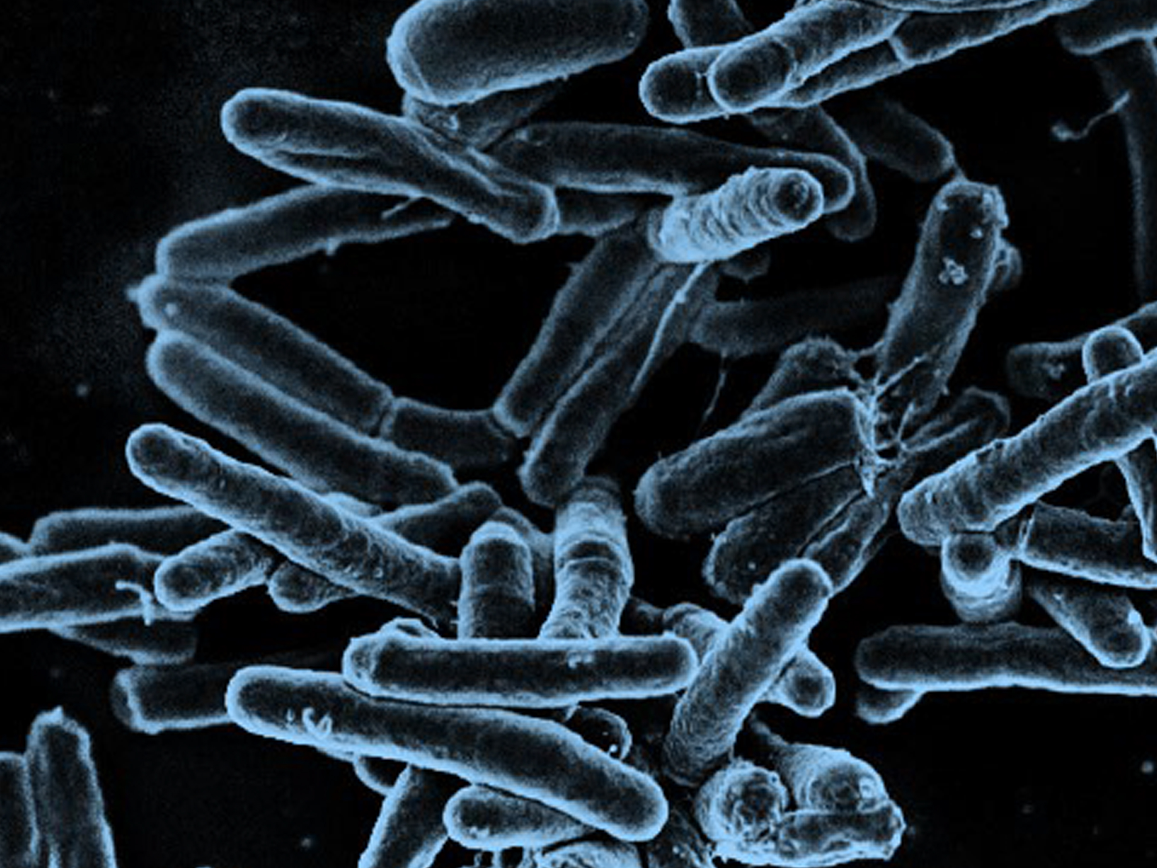 Scanning electron micrograph of Mycobacterium tuberculosis bacteria colorized in blue on a black background.