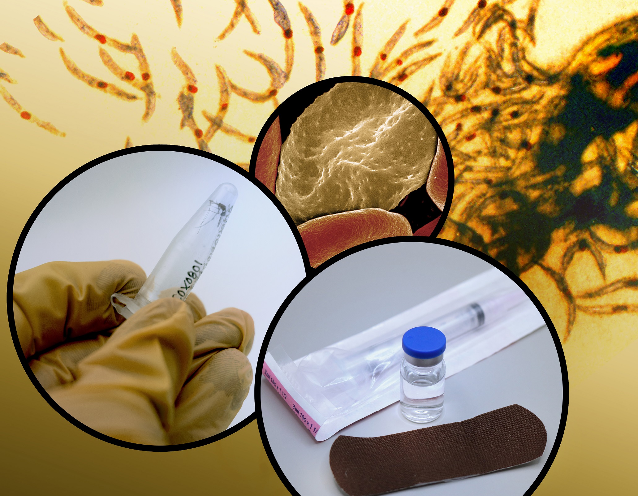 Background image of malaria parasites with foreground photo montage showing infected red blood cell, mosquito, and vaccine vial.
