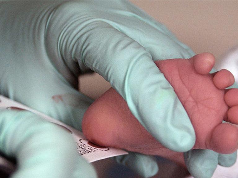 Blood is collected from a newborn for screening.