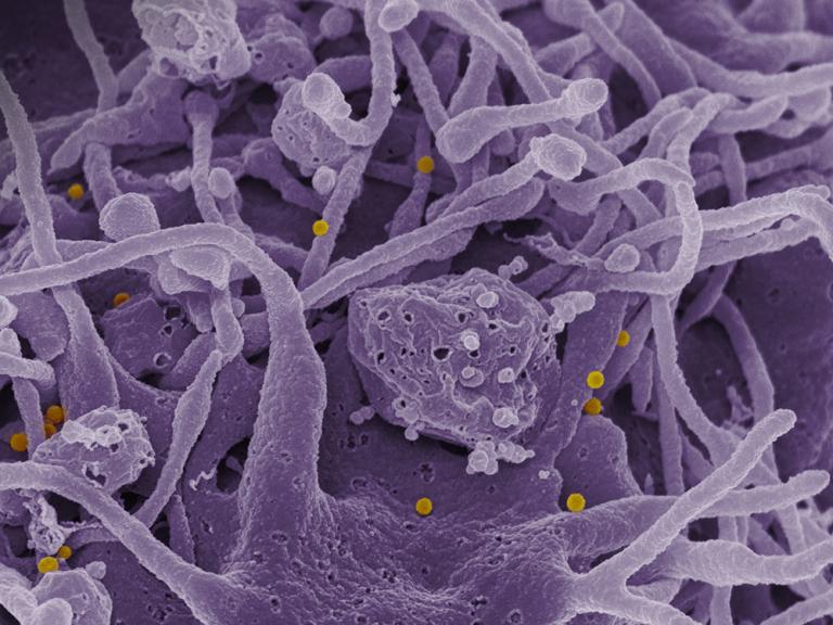 purple cells in the background, yellow virus spheres in front
