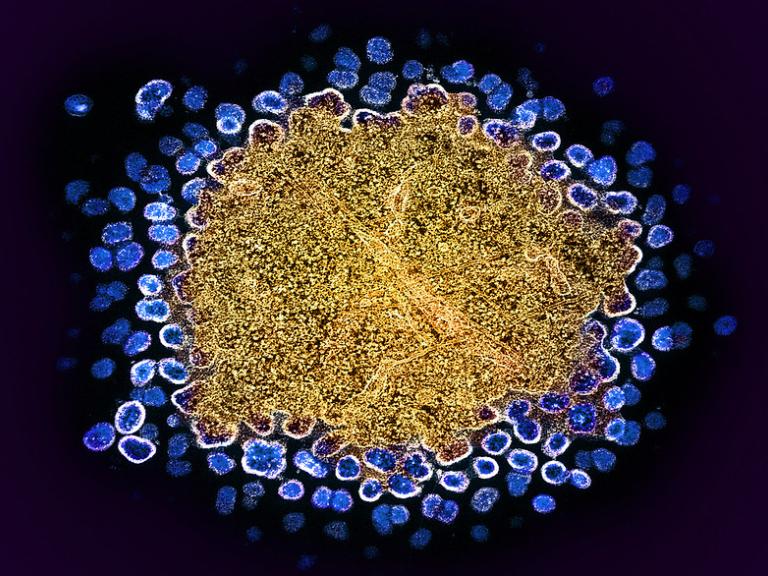 Closely clustered blue circles with irregular surfaces around gold center.