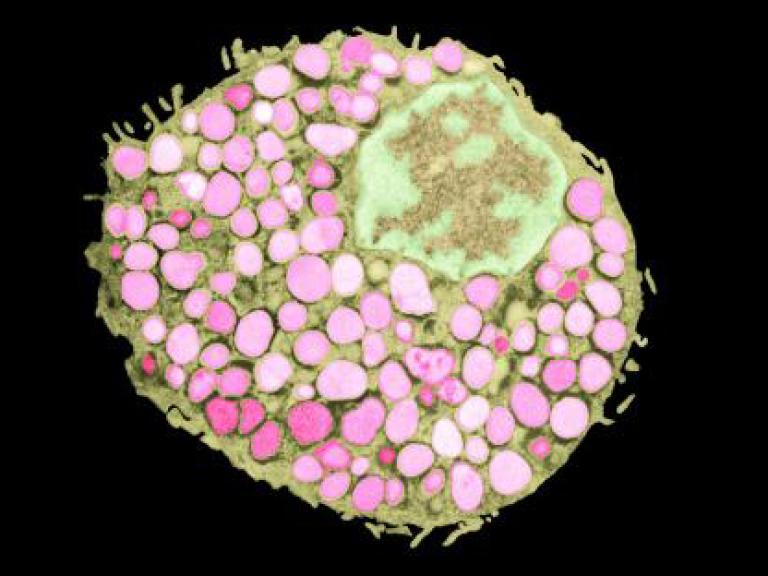 Semi-oval shape filled with many small pink circles and one large, green-and-beige amorphous shape.