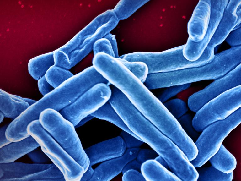 Scanning electron micrograph of oblong Mycobacterium tuberculosis particles colorized blue on red background.