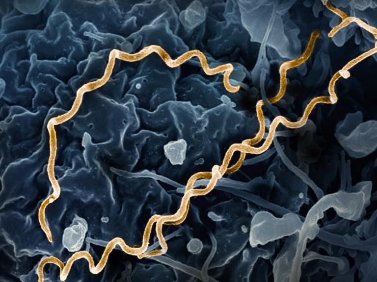 image of long corkscrew-shaped bacteria on background of cells