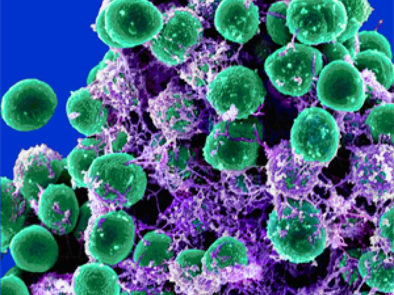 Scanning electron microscopy of Staphylococcus epidermidis cluster embedded in exopolysaccharide matrix. Credit: NIAID