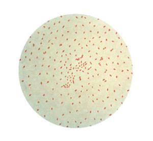 Image of bImage of bordetella pertussis bacteria