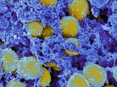 Scanning electron micrograph of Staphylococcus aureus bacteria.