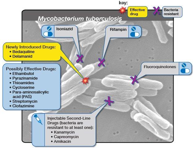 Bedaquiline and Delamanid are new drugs. Ethambutol, Pyrazinamide, Thioamides, Cycloserine, Para-aminosalicylic acid, Streptomycin, and Clofazimine are possibly effective. Kanamycin, Capreomycin and Amikacin are injectable second-line.