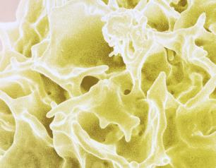 pink background, yellow T cell