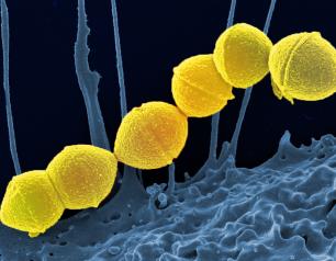 Colorized scanning electron micrograph of Group A Streptococcus (Streptococcus pyogenes) bacteria (yellow) and a human neutrophil (blue).