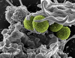 Scanning electron micrograph of methicillin-resistant Staphylococcus aureus (MRSA) bacteria (colorized green) interacting with a human neutrophil. The bacteria shown is strain MRSA252, a leading cause of hospital-associated infections in the U.S. and U.K. Image captured at NIAID's Rocky Mountain Laboratories (RML) in Hamilton, Montana.