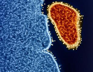 Colorized transmission electron micrograph of an extracellular Nipah virus particle (red) on the periphery of an infected VERO E6 cell (blue). Nipah virus surface glycoproteins have been identified using a technique called “immunogold labeling,” in which gold particles (yellow) are bound to antibodies that recognize a specific viral antigen or epitope. Captured at the NIAID Research Facility in Fort Detrick, Maryland.