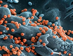 gray cell with orange spheres budding off